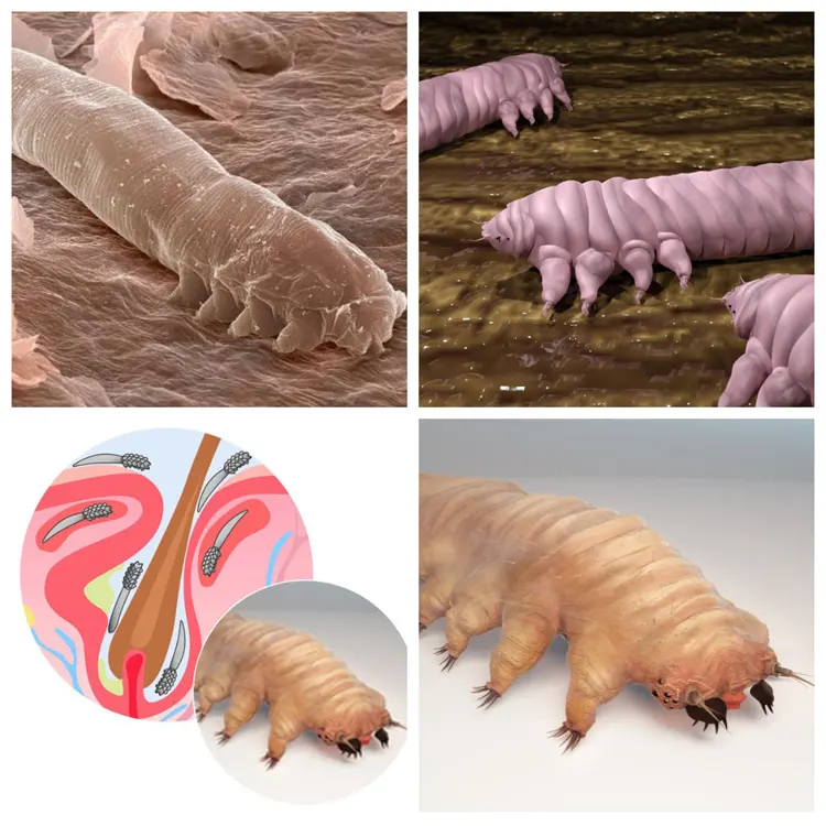 Так вигладяє кліщ Demodex під мікроскопом